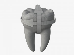 tooth molars with arrows 01 Model 3D