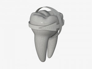 tooth molars with arrows 01 Model 3D