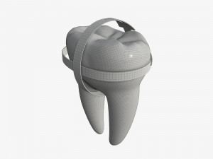 tooth molars with arrows 01 Model 3D