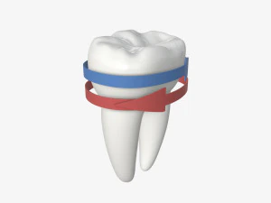 tooth molars with arrows 02 3D Model