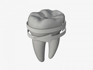 tooth molars with arrows 02 3D Model