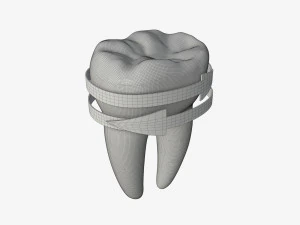 tooth molars with arrows 02 3D Model