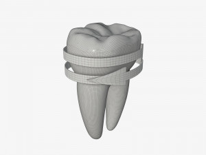 tooth molars with arrows 02 3D Model