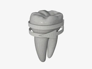 tooth molars with arrows 02 3D Model