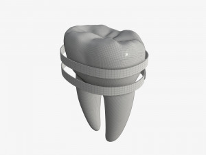 tooth molars with arrows 02 3D Model