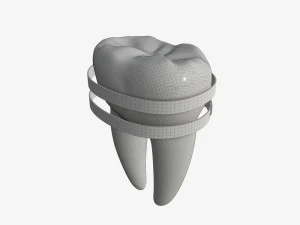 tooth molars with arrows 02 3D Model