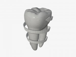 tooth molars with arrow 03 3D Model