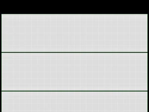 蜘蛛式过滤器套装 3D 模型