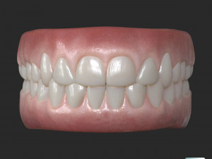 Human Teeth Gums 3D Model