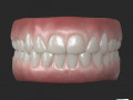 Human Teeth Gums Modèle 3D