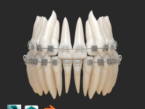 Teeth 3D Model