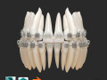 Teeth 3D 모델