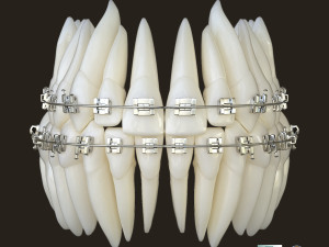 Teeth Model 3D
