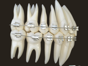 Teeth Model 3D