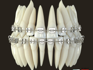 Teeth Model 3D