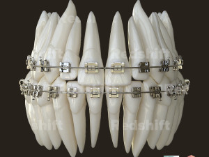 Teeth Model 3D