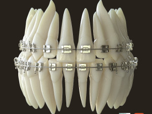 Teeth Model 3D