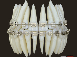 Teeth Model 3D