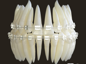 Teeth Model 3D
