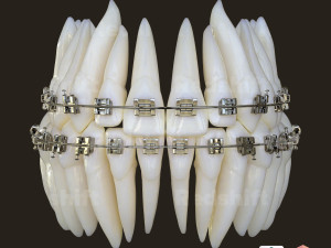 Teeth Model 3D