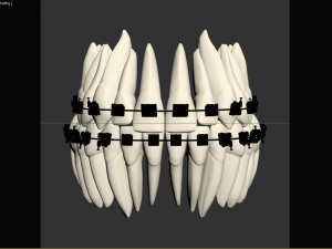 Teeth Model 3D