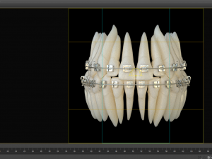 Teeth Model 3D