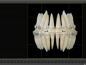 Teeth 3D Model