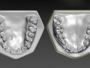 Teeth Modèles 3D en vedette