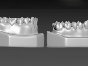Teeth Modèles 3D en vedette