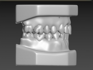 Teeth Modèles 3D en vedette