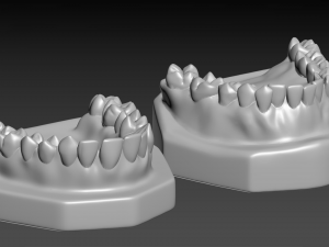 Teeth Modèles 3D en vedette