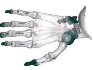 hand prosthesis the current anatomical model Model Cetak 3D