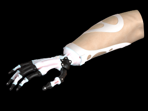 hand prosthesis the current anatomical model Model Cetak 3D