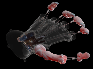hand prosthesis the current anatomical model Model Cetak 3D