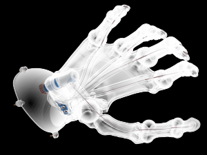 hand prosthesis the current anatomical model Model Cetak 3D