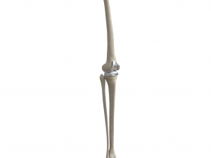 Knee Replacement Implant 3D-Modell