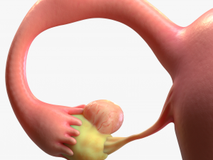 Female Reproductive System Cyst 3D Модель