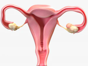 Female Reproductive System Cyst 3D Model
