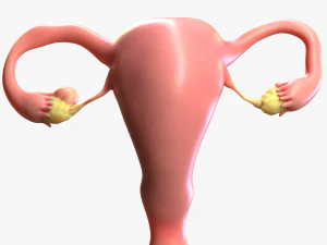Female Reproductive System Cyst 3D Model