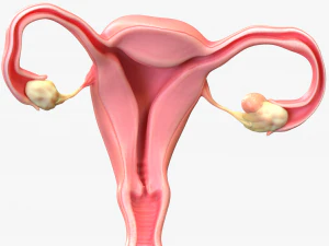Female Reproductive System Cyst 3D Model