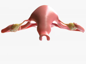 Female Reproductive System Cyst 3D Model
