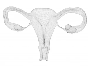 Female Reproductive System Cyst 3D Model