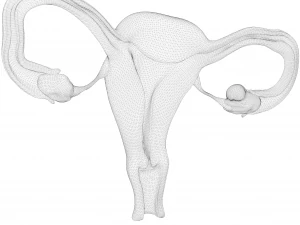 Female Reproductive System Cyst 3D Model