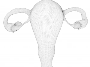 Female Reproductive System Cyst 3D Model