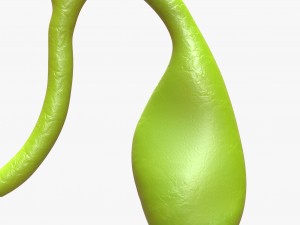 Gallbladder With Gallstones Model 3D
