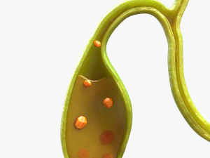 Gallbladder With Gallstones 3D Model