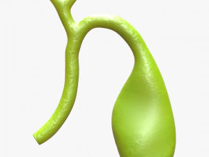 Gallbladder With Gallstones 3D Model