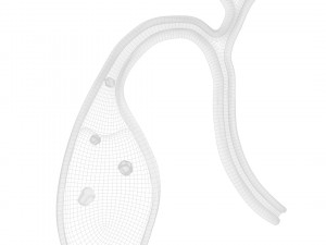 Gallbladder With Gallstones 3D Modell
