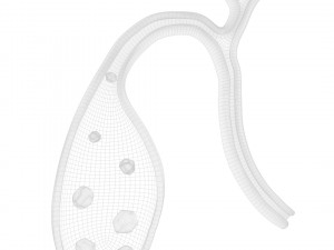 Gallbladder With Gallstones 3D Modell