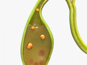 Gallbladder With Gallstones 3D Model